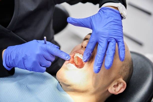 Best Lost Filling or Crown Replacement in Sanger, TX