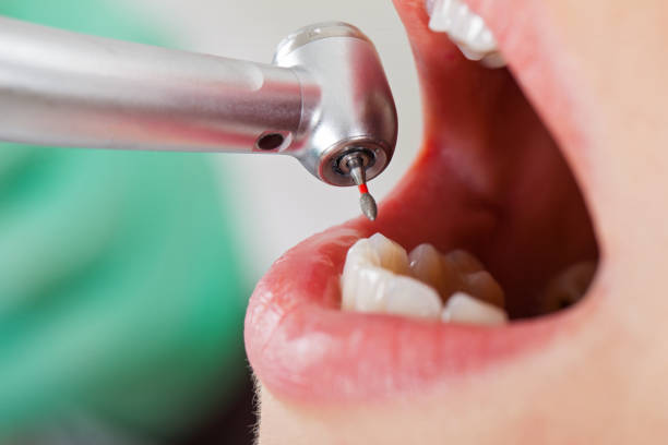 Best Emergency Dental Care for Sports Injuries in Sanger, TX